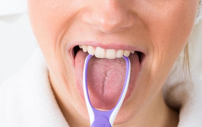 Un extraño trastorno médico le da una apariencia "peluda" a la lengua