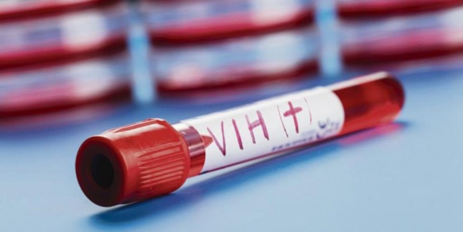 Nueva cepa de VIH descubierta