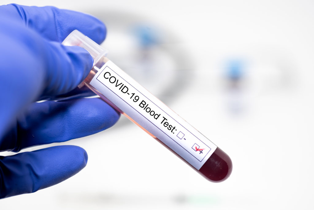 Detectar el coronavirus mediante la sangre del paciente