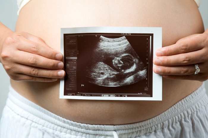Mujer embarazada sosteniendo un ultrasonido frente a su barriga