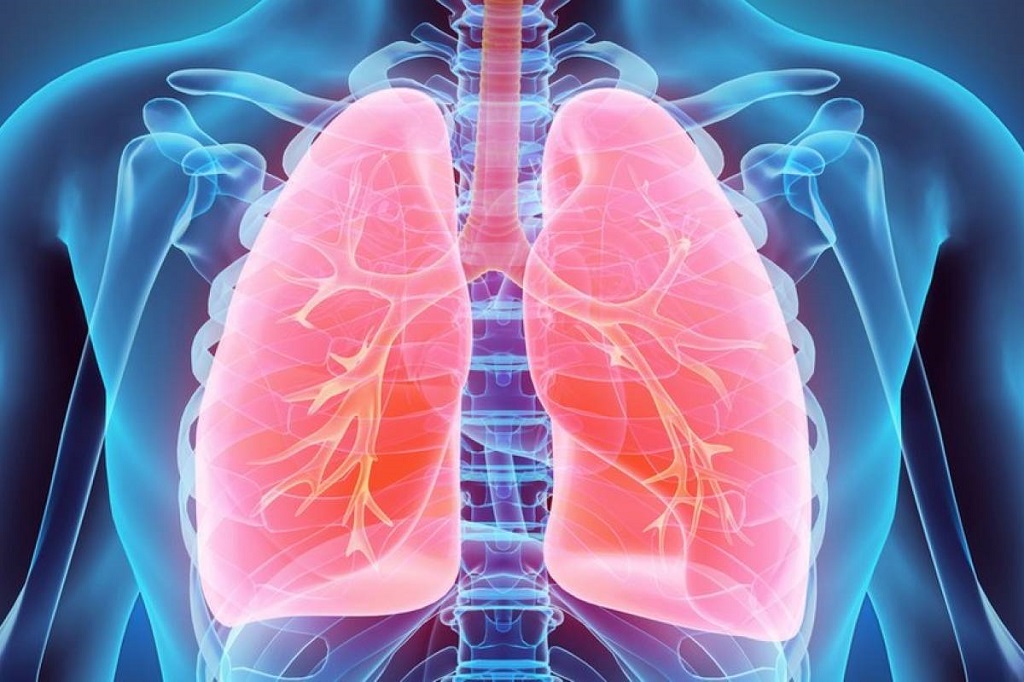 Radiografía que muestra los pulmones de color rojo