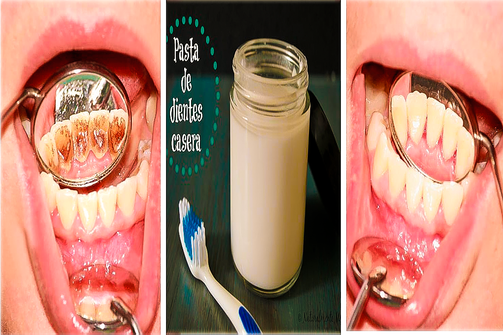 elimna las placas oscuras de los dientes