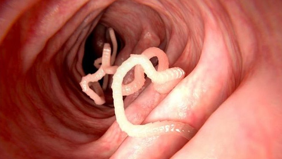 Parásitos intestinales 4